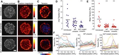 Expression of vimentin alters cell mechanics, cell-cell adhesion, and gene expression profiles suggesting the induction of a hybrid EMT in human mammary epithelial cells